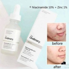 The Ordinary Niacinamide 10% Zinc 1% Serum 30ml Anti-Acne In Pakistan
